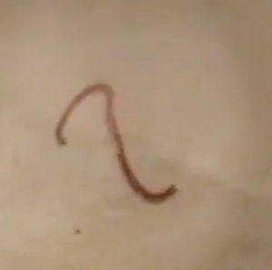 do pin worms move in toilet poop