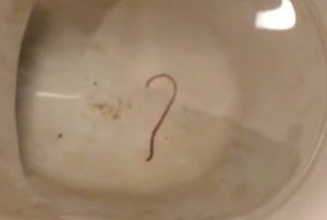 i keep seeing flat shaped worms in the toilet. what are they?