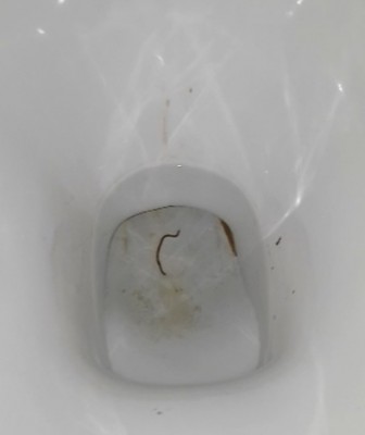 roundworm in toilet - All About Worms
