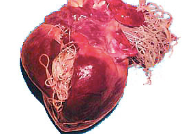 heartworm in human