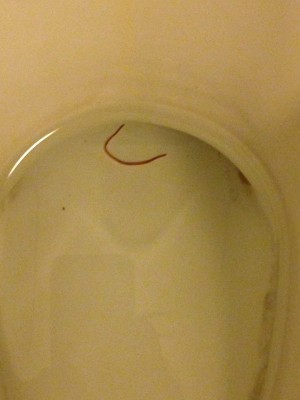 flat brown worm in toilet