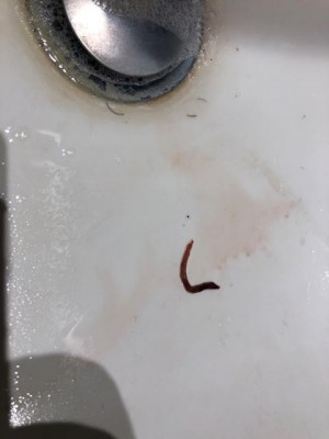Worm In Toilet Bowl Is Not Parasitic All About Worms