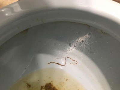 Are Worms in Stool Parasitic? - All About Worms