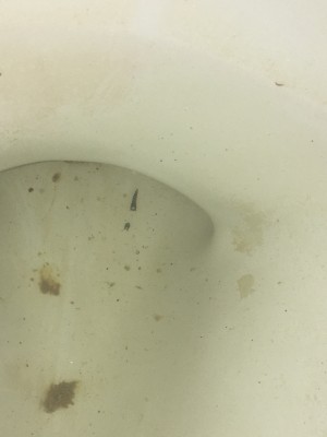 parasite eggs in toilet