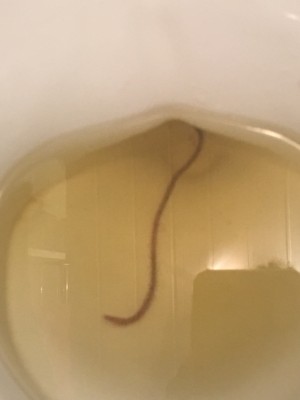 Worm In Toilet Probably Not From Reader's Body - All About Worms