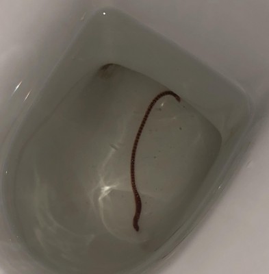 i keep seeing flat shaped worms in the toilet. what are they?