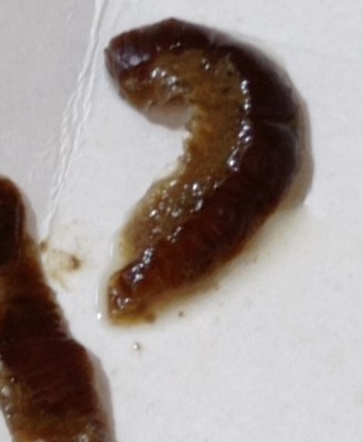 worms in human diarrhea