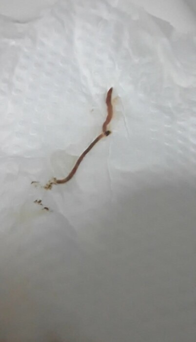 Tiny Pink Worms in Bathtub are Baby Earthworms - All About Worms